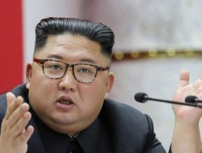 Kim Jong-Un resmen süzüldü! Kuzey Kore liderinin son hali