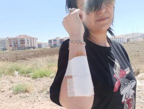 Ankara'da bir kadın, 12 köpeğin saldırısına uğradı