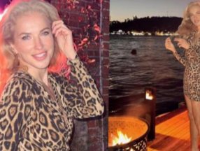 Burcu Esmersoy, estetik iddialarına yanıt verdi