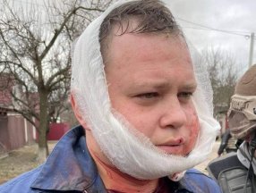 Suriye'de sivilleri bombalayan Rus pilotun Ukrayna'da yakalandığı anlar