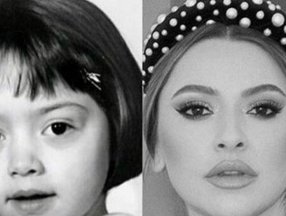 Hadise'nin çocukluk fotoğrafı Mehmet Dinçerler'e benzetildi