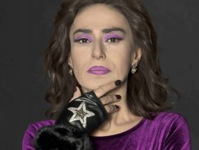 Yıldız Tilbe'den başıboş köpek çıkışı: Sevmek için bir sebep göremiyorum