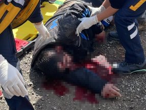 Düzce'de otomobile çarpan motosikletli, yola savruldu