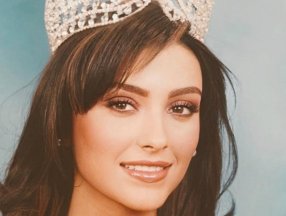 Özge Ulusoy eski ve yeni hallerini paylaştı