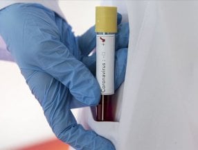 Tevfik Özlü: Mutaston, koronavirüsü azalttı