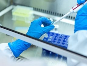 İngiltere'de 74 çocukta hepatit vakası saptandı