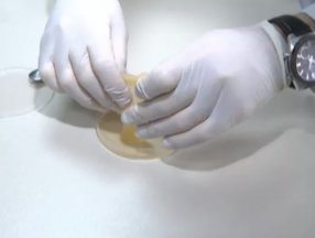 Boğaziçili öğrenciler, hastadan alınan numuneyle yapay deri üretti