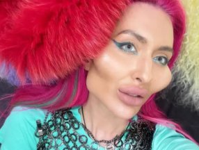 Dünyanın en büyük yanaklısı Anastasia Pokreshchuk dolgu yaptırdı