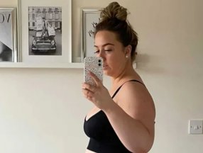 İngiliz kadın, Türkiye'de kilo verme ameliyatı oldu