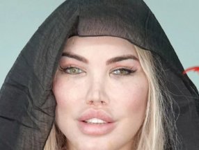 Jessica Alves estetikten tanınmaz hale geldi