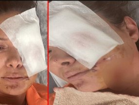 Sevda Demirel, Tuğba Altıntop’a köpeğin saldırdığına inanmadı