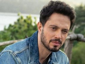 Murat Boz saç ektirdi