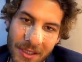 Tarık Emir Tekin, Mustafa Mert Koç'un burnunu kırdı