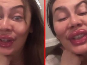 Demet Evgar, botoks ve dolguyu fazla kaçıranları ti’ye aldı