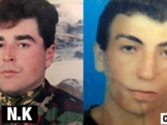 İkinci yüz nakli operasyonu tamam