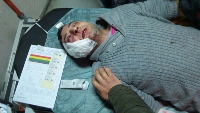 Okmeydanı Hastanesi önünde polise taşlı saldırı İZLE