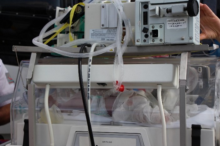 Bolu'da saç kurutma makinesi 13 günlük bebeği yaktı