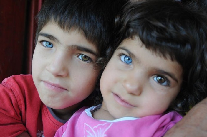 Bu çocukların gözlerinin biri mavi biri kahverengi