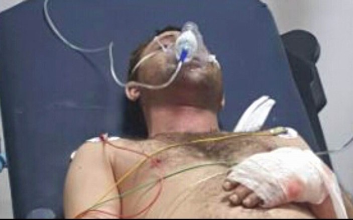 Samsun’da korkutan patlama