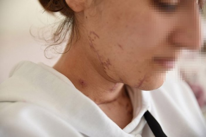 İstanbul'da öldü sanılan genç kızın akılalmaz kurtuluşu