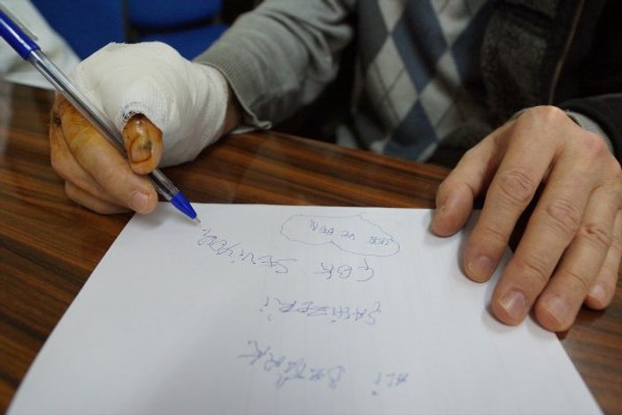 53 yıl sonra sağ eline kavuştu