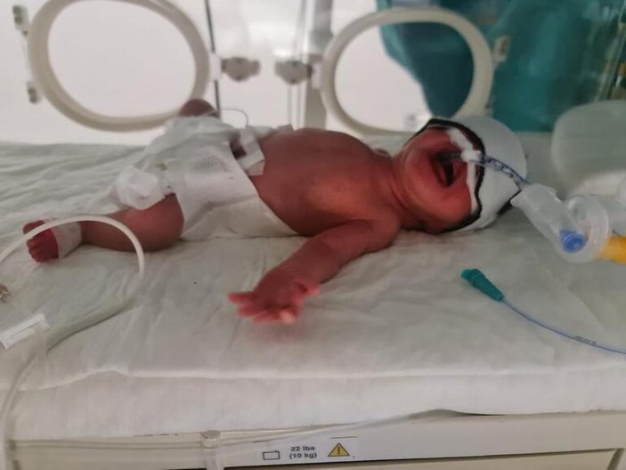 Van'da hamile kadının rahminden 5 kilo miyom çıkarıldı