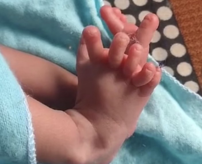 Hindistan'da 26 parmaklı bebek doğdu